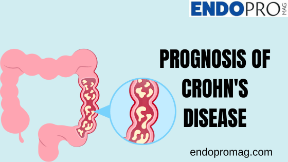 Prognosis of Crohn's Disease