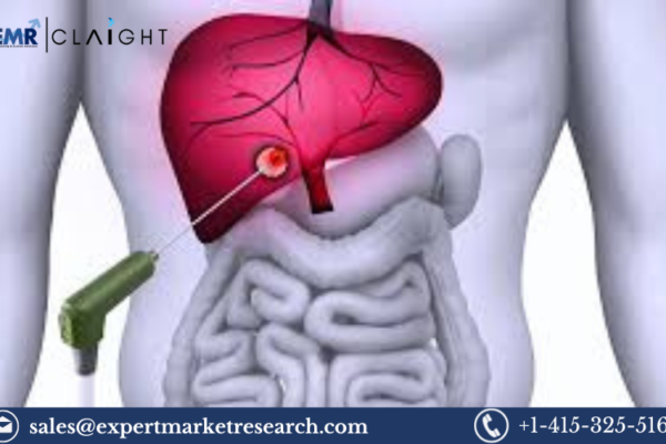 Asia Tumor Ablation Market