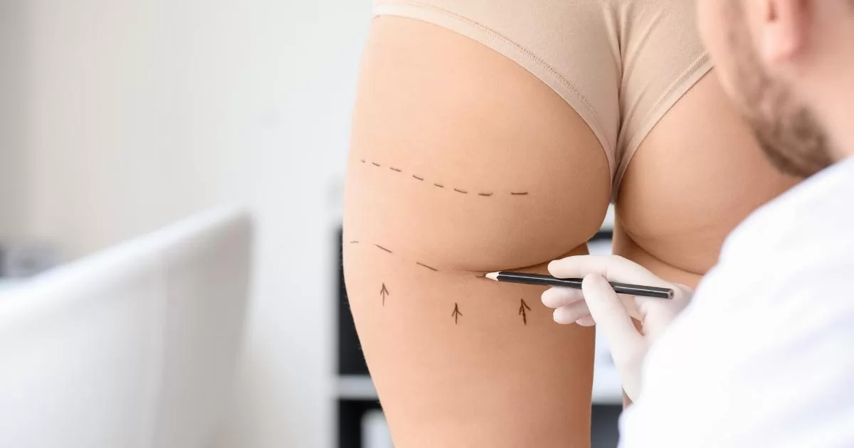 Best Aesthetic Clinic in Dubai Understanding the Cost of Butt Fillers