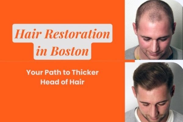 Hair-Restoration-in-Boston-Your-Path-to-Thicker-Head-of-Hair