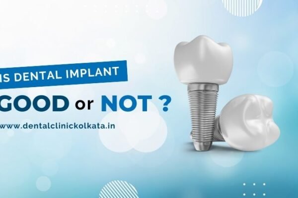 dental implants,dental implant clinic