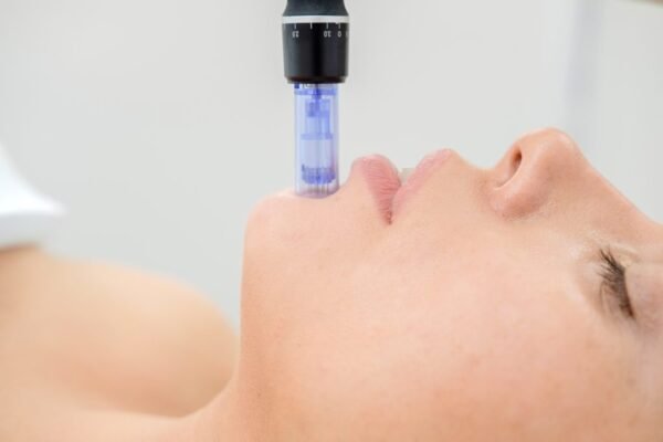 microneedling fort collins