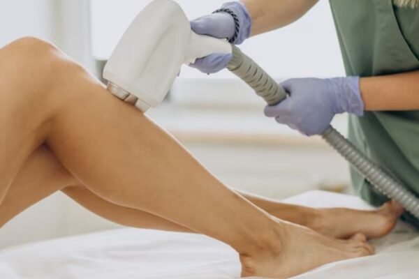 laser-hair-removal-in-houston