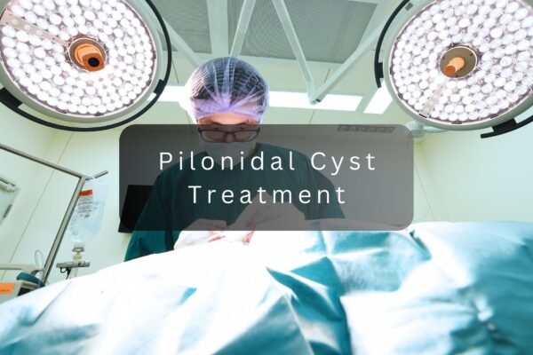 pilonidal cyst treatment