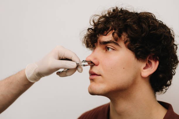 A Guide to Recovery After Rhinoplasty