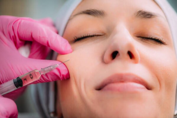 Common Myths About Cheek Filler Injections Debunked