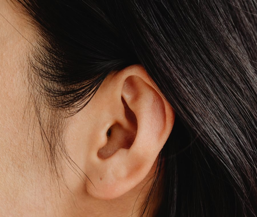 Common Myths About Ear Reshaping Debunked