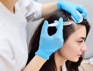 Effective PRP Hair Treatment Solutions 