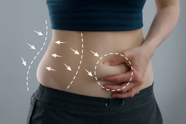 Exploring the Unique Flavors of Tummy Tuck