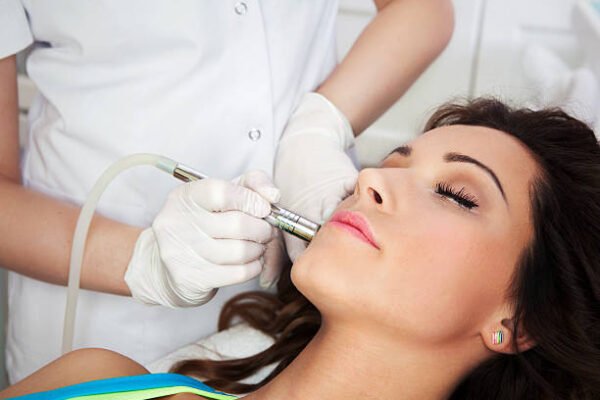 Steps to Prepare for Laser Acne Scar Treatment