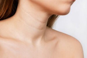 The Rise of Neck Lift Procedures 