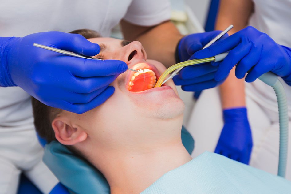 Understanding the Process of Tooth Extraction in Doreen