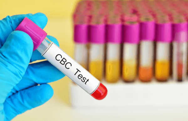 CBC Test in Bangalore