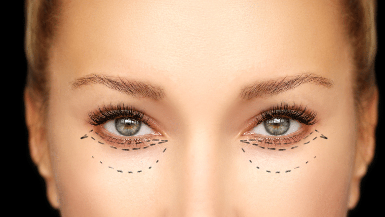 Discover the Best Eyelid Surgery