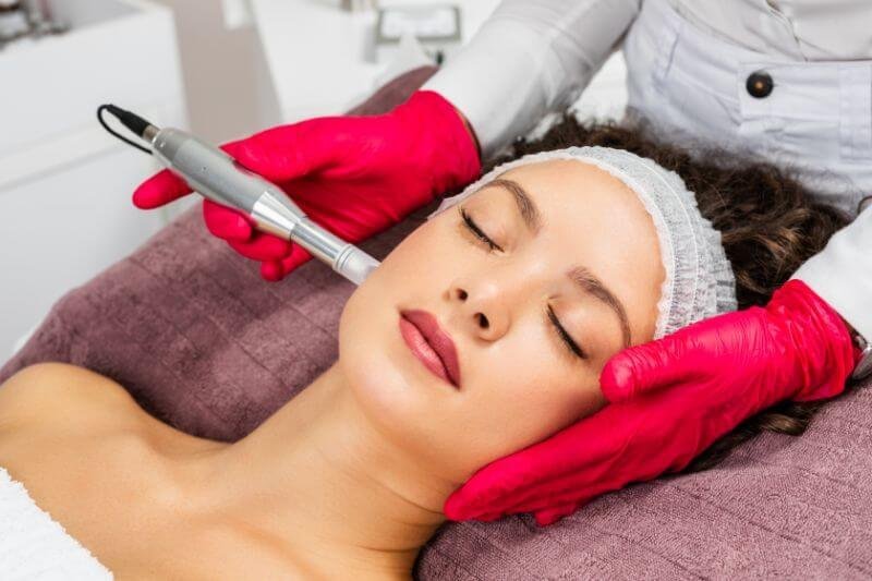 How Does Microneedling Compare to Other Treatments