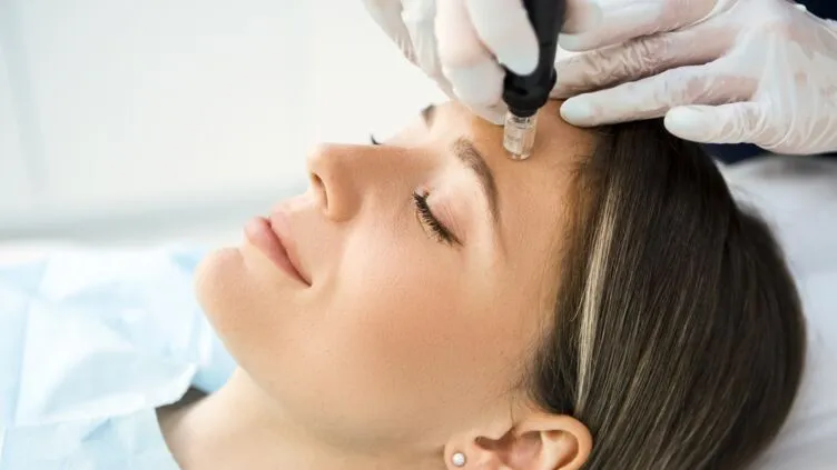 Is Dermapen Microneedling a Permanent Solution in Abu Dhabi