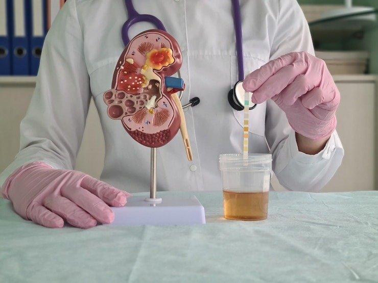 Kidney Function Test (KFT) Price in Delhi