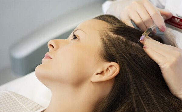 Professional Hair Fillers Therapy for Fuller Hair