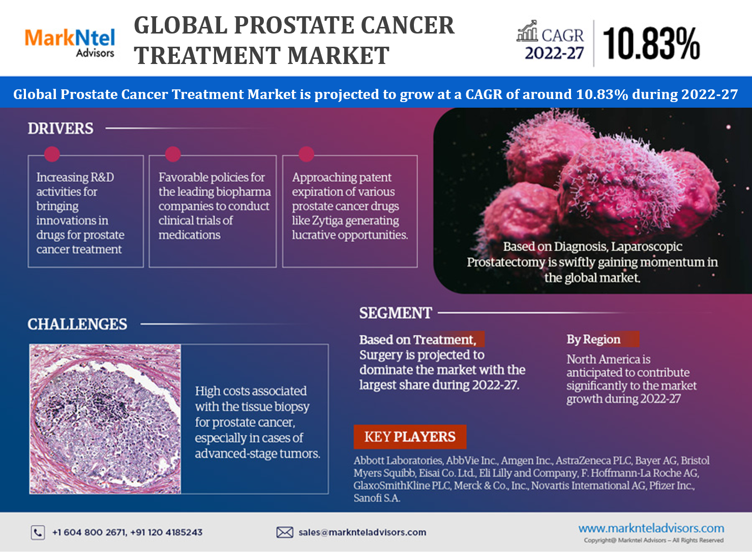 Prostate Cancer Treatment Market