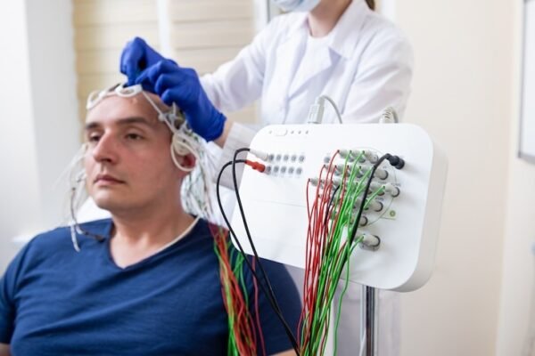 EEG test price in delhi