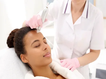 Local microneedling treatment