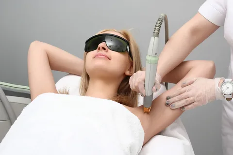 Underarm laser hair removal