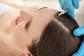 Breaking Down PRP Hair Treatment Prices in the UK: Affordable Options and Top Clinics