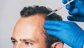 Hair Care Solutions in Stafford: PRP, Restoration, and More