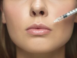 Advanced Techniques for Lip Augmentation