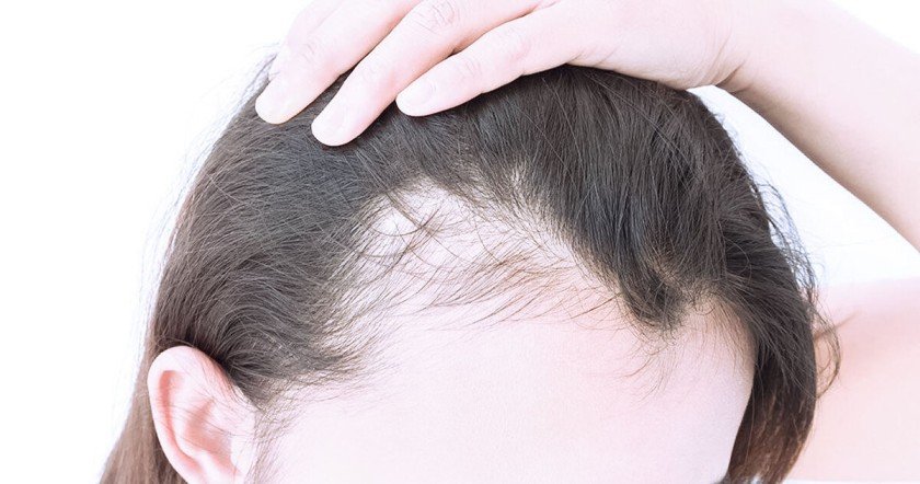 Best Hair Treatment for Thin Hair