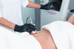 CoolSculpting for Targeted Fat Removal 