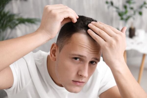 How Many Sessions Are Needed for FUT Hair Transplant?