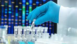 Immunoblot Western Blot