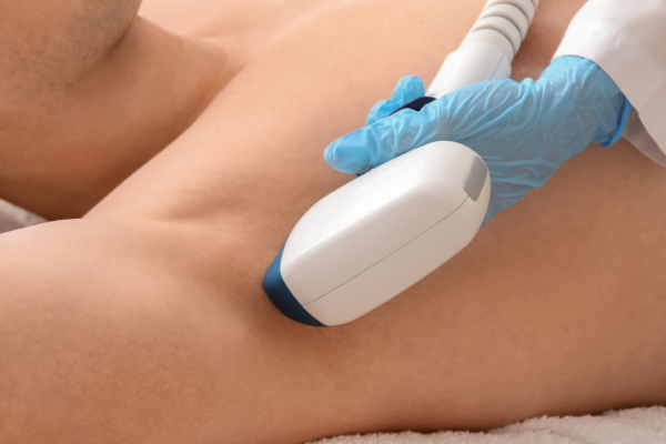 Pain-Free Full Body Laser Hair Removal