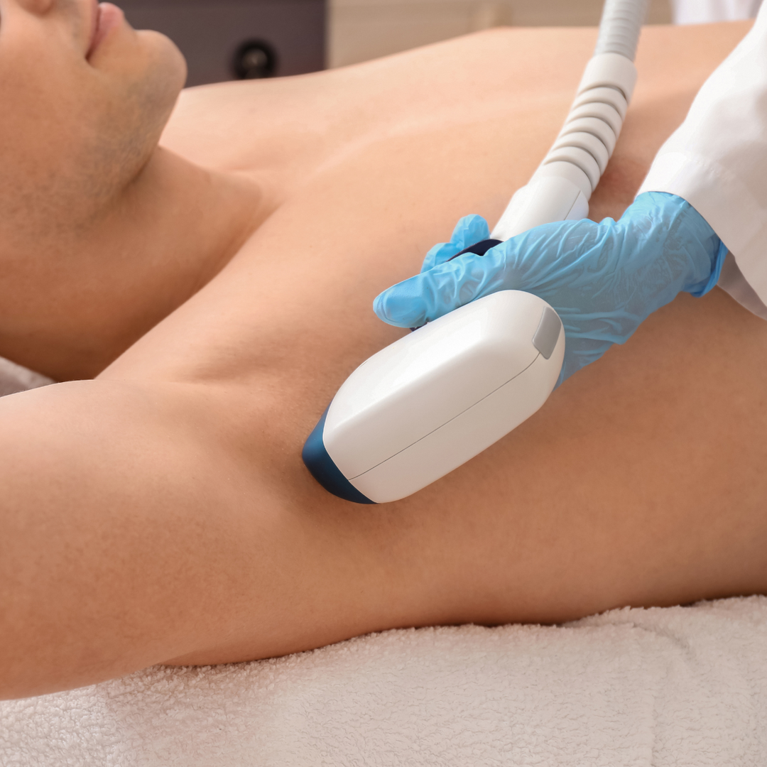 Pain-Free Full Body Laser Hair Removal