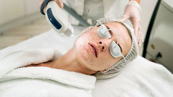 Reclaim Your Confidence with Laser Acne Scar Treatments