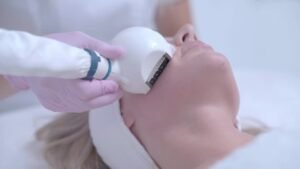 Restore Your Youthful Glow with Fractional CO2 Laser