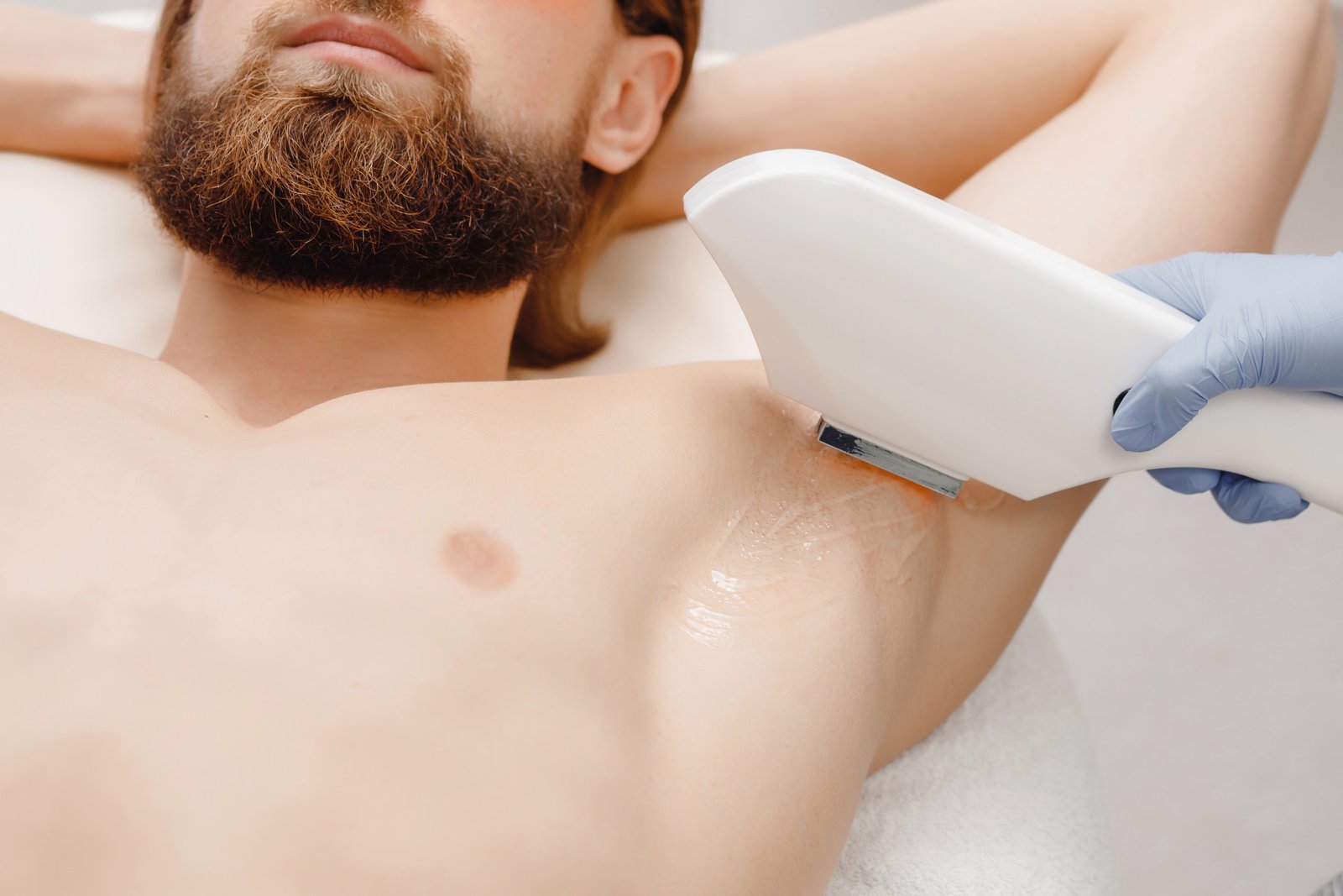 Tailored Men's Laser Hair Removal Solutions