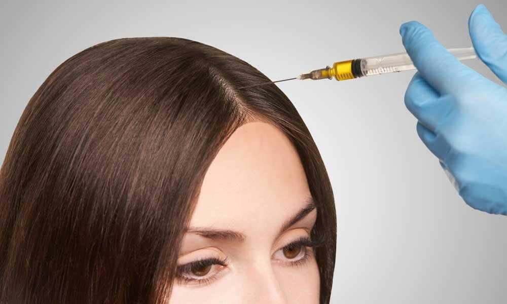 What are the Do's and Don'ts for PRP Hair Treatment?