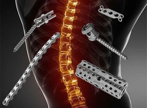 Brazil Spinal Surgery Devices Market