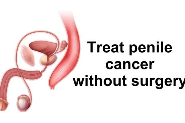 Penile cancer, though relatively rare, is a serious condition that affects the male genital organ. When early signs of penile cancer is highly treatable