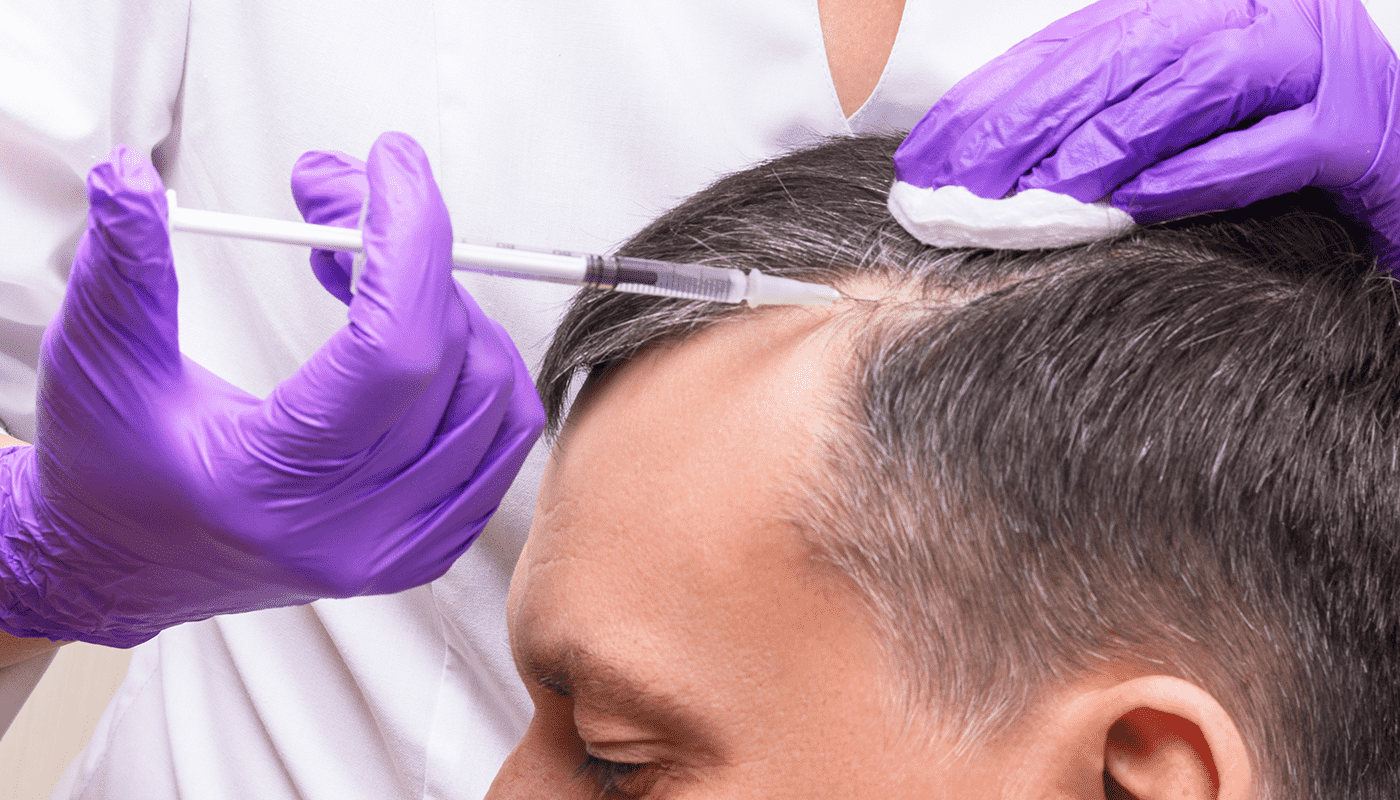 How Long Does PRP for Hair Loss Take to Work?