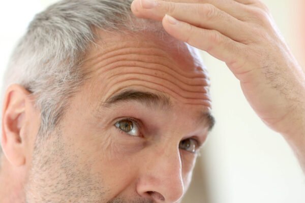 How to Strengthen Weak Hair with Expert Treatments