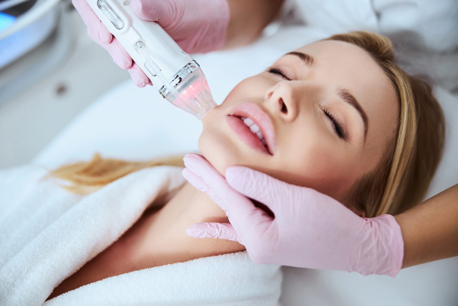 Say Goodbye to Wrinkles with Microneedling