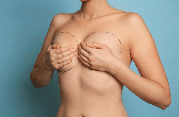 What to Expect During Breast Lift Surgery