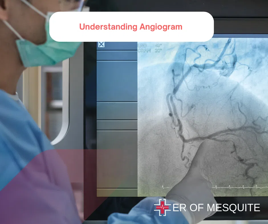 cardiac ct scan vs angiogram